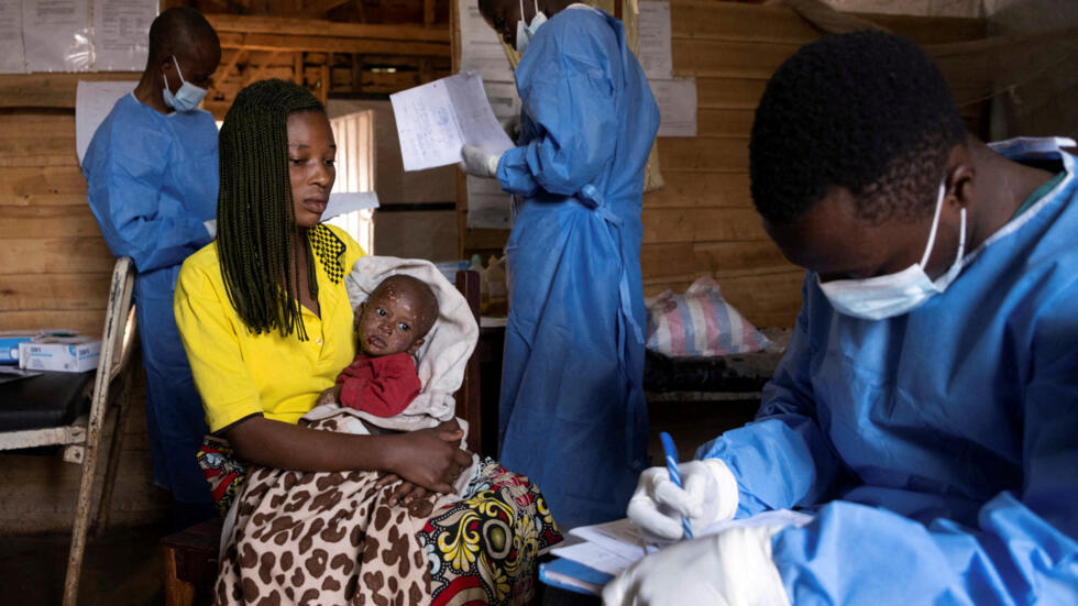 WHO Investigates Mysterious Disease Outbreak in DR Congo Affecting Children