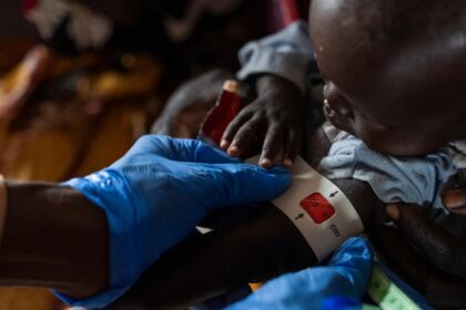 At least 239 children die from malnutrition in western Sudan, medical group says