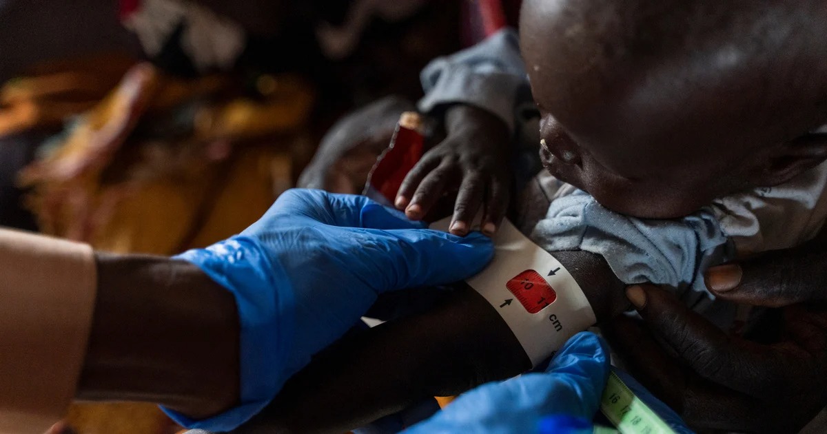 At least 239 children die from malnutrition in western Sudan, medical group says